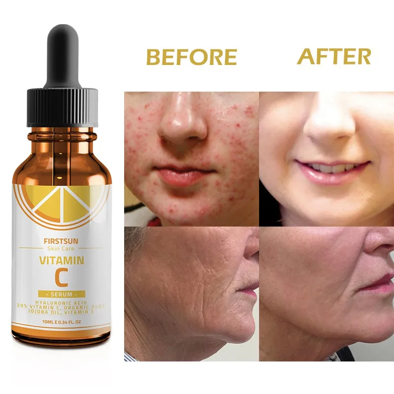 vitamin-c-face-serum-hyaluronic-acid-whitening-anti-aging-fade-spots