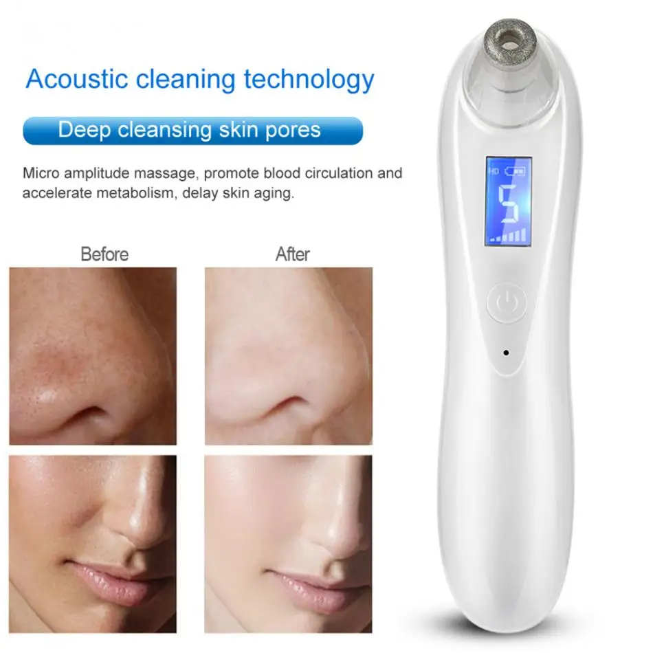 Электрический Очищающая маска для лица BlackHead Cleaner акне Remover вакуумный очиститель пор уход за кожей лица tool Kit Красота машины