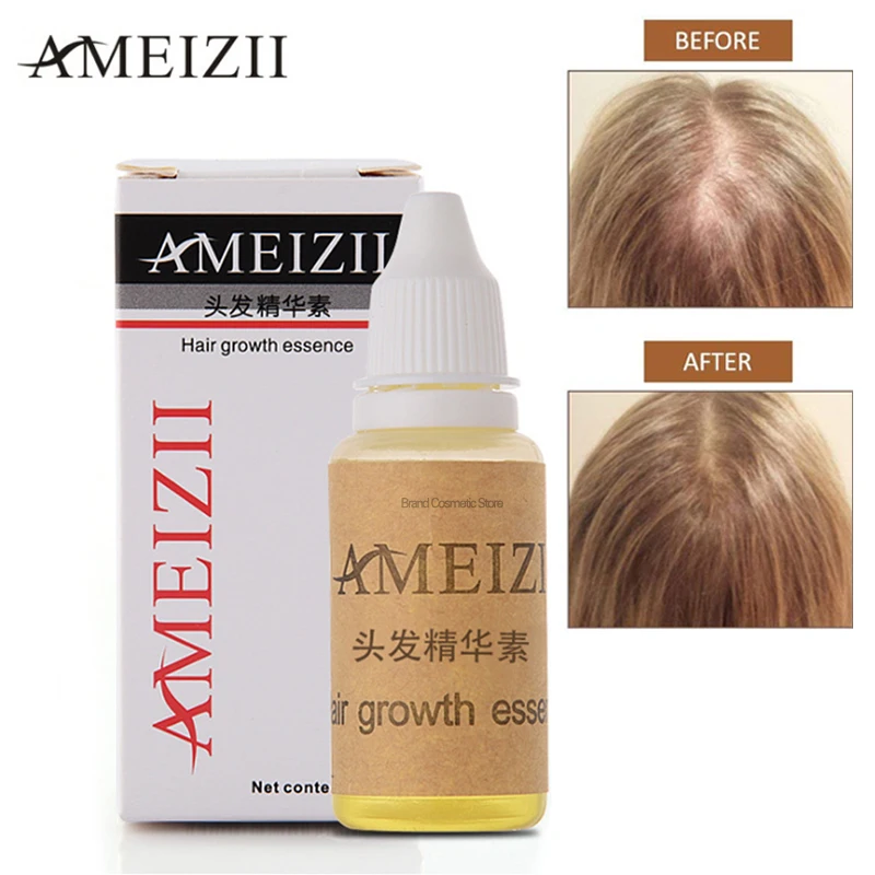 

20ml Ameizii Hair Growth Essence Hair Thickening Serum Ginger Extract Sunburst Anti Hair Loss Oil
