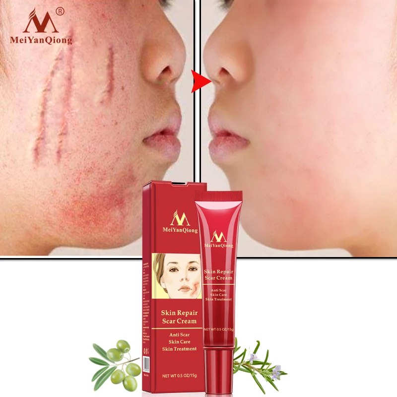 

MeiYanQiong 15ML Acne Scar Stretch Mark Repair Cream Treatment Blackhead Whitening Cream Skin Repair Face Cream