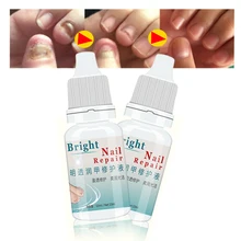 Грибковая жидкость для лечения Ногтей удаление ногтей ног для Onychomycosis гель для ногтей эссенция масло гель для ногтей макияж 10 мл