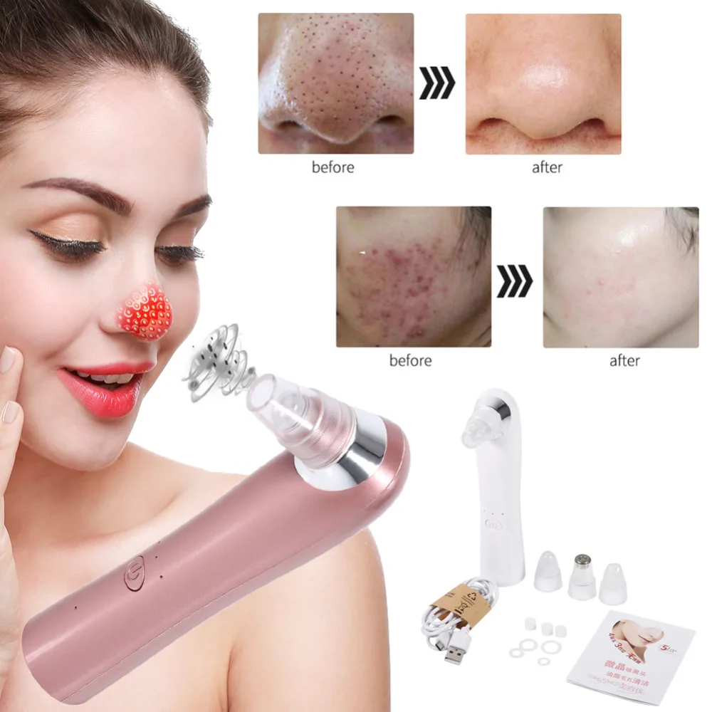

Vacuum Pore Cleaner 2 Colors Electric Facial Skin Pore Cleaner Acne Nose Blackhead Removal Suction Face Beauty cleaning Tools