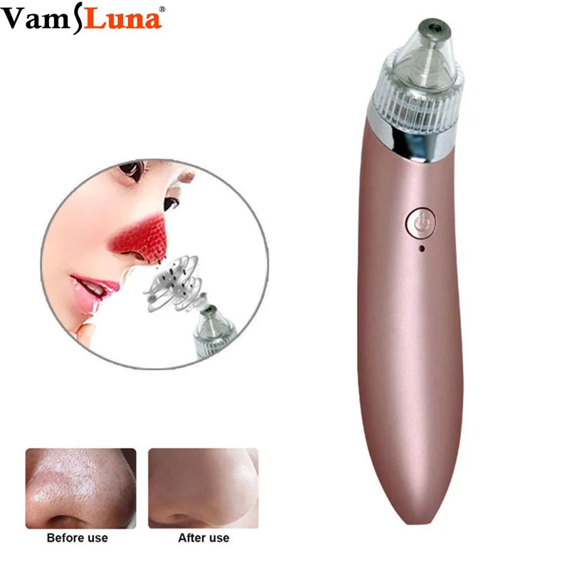 

Blackhead Remover Pore Vacuum Cleaner - Electric Facial Skin Care Cleaner Remover Acne Cleanser With 4 Heads