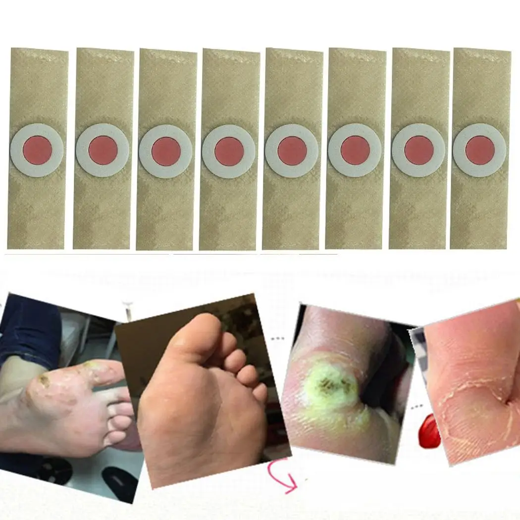 50 piezas de yeso de maíz sin dolor removedor de maíz pies cuidado de color caqui verrugas parche de yeso de espino para pies 50 piezas de yeso de maíz sin dolor removedor de maíz pies cuidado de color caqui verrugas parche de yeso de espino para pies