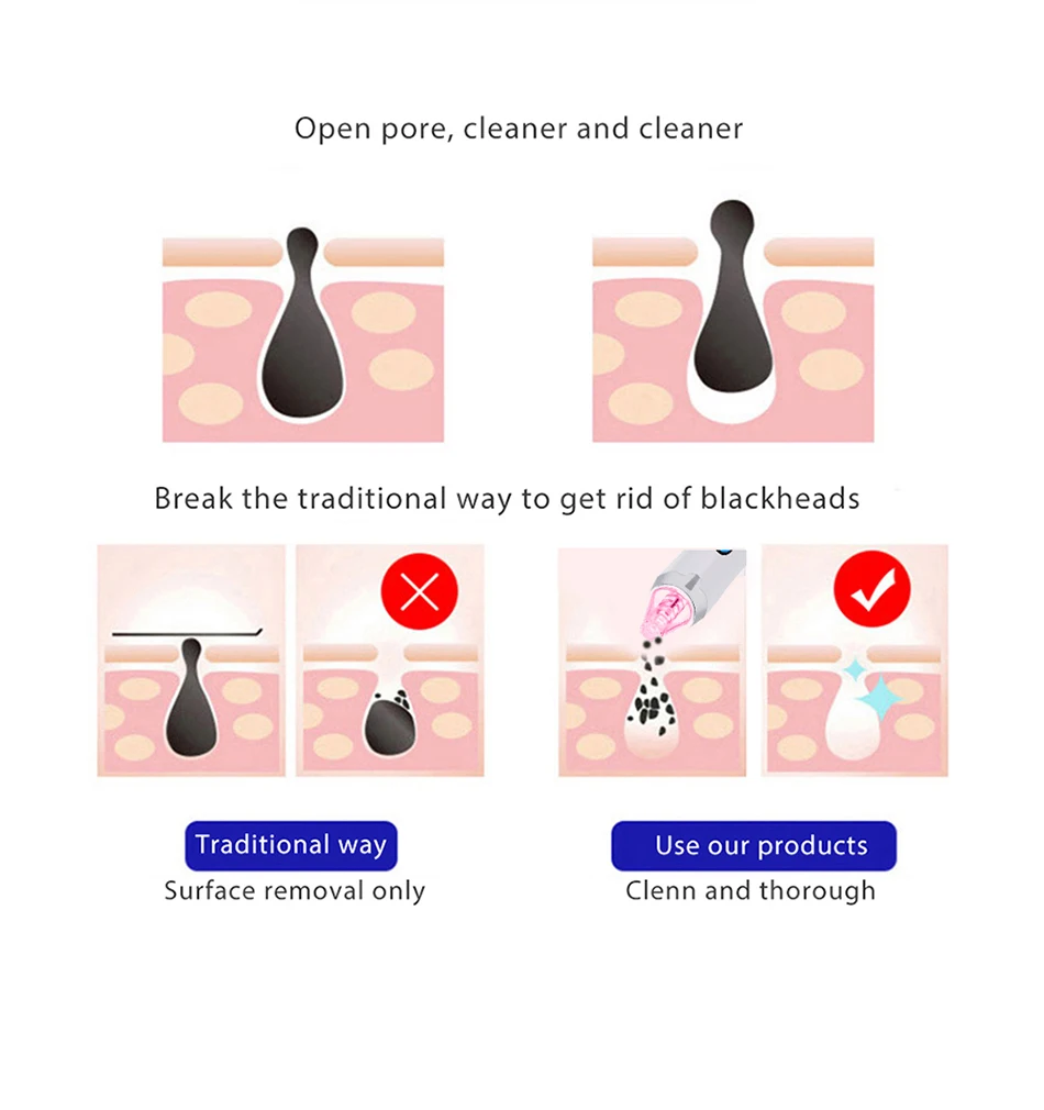 Очиститель пор угорь для удаления прыщей Удаление прыщей лица глубокое очищение в черный горошек вакуумных аппарат для алмазной