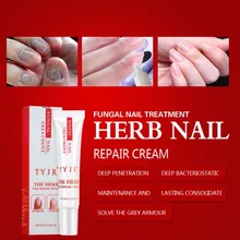 1 шт. грибковое Лечение ногтей для ногтей на ногах и ногти на руках ноготь против грибка онихомикоза втирать ногти ремонт крем