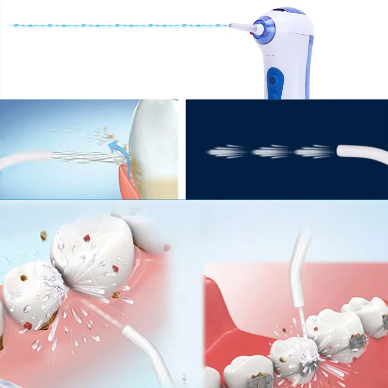 Beste 120 Ml Usb Elektrische Oplaadbare Draagbare Monddouche Tanden Bleken Water Tank Draagbare Dagelijks Floss Pick Voor Tanden