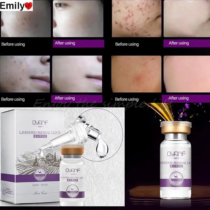 3PCS Lavender Essence Serum Anti Allergy,Remove Acne Scar,Relieve