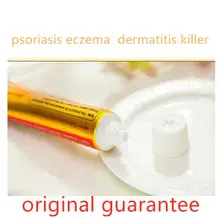 1 pçs/lote yiganerjing zudaifu dropshipping pele psoríase creme dermatite eczematoid eczema pomada sem caixa de varejo
