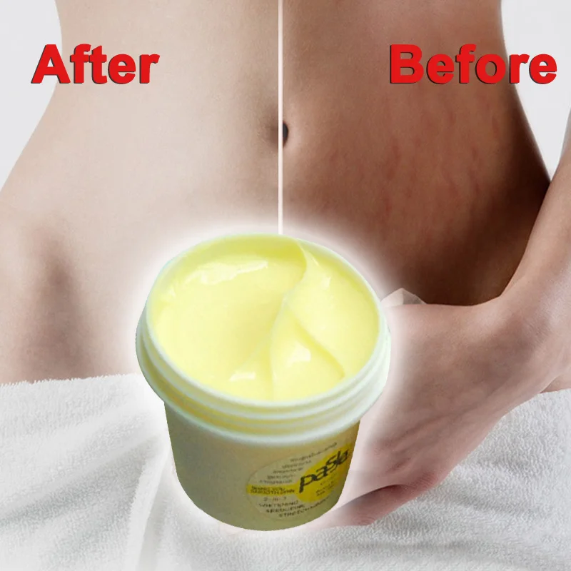 Lubricants Product Thailand Skin Remove Stretch Marks Treatment Postpartum Repair Whitening CREAM Pregnancy Scar Removal