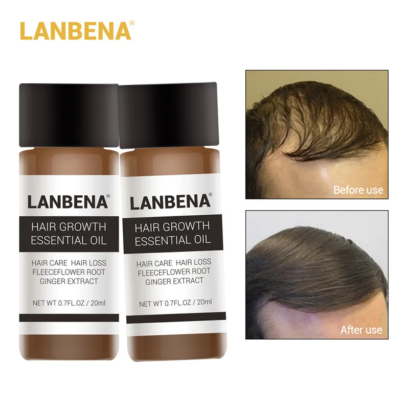 

LANBENA Hair Oil Hair Care Fast Powerful Hair Growth Products Regrowth Essence Liquid Treatment Preventing Hair Loss For Men And