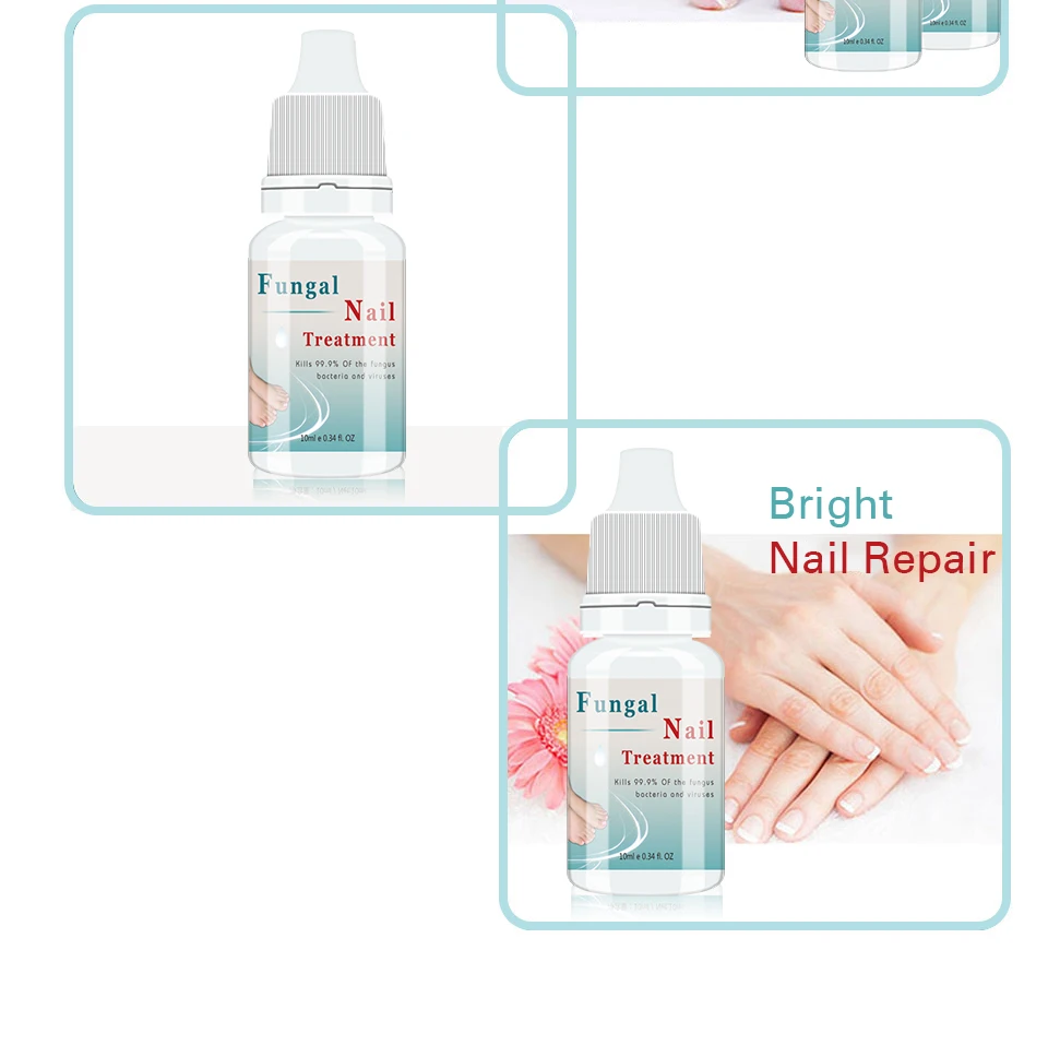 лечение ногтей волжский фуст. Meiyanqiong lavender fungal nail. лекарства от онихомикоза ногтей. лечение ногтей волжский фуст. лечение ногтей волжский фуст.