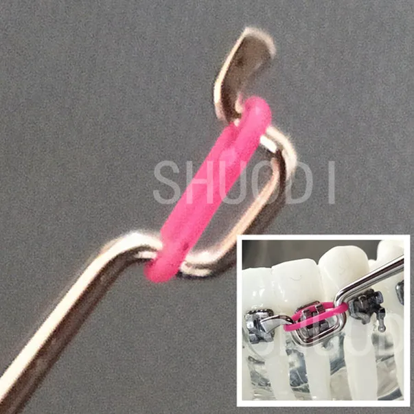 Dental Orthodontic TWIRL ON Module Ligature Tie Placer Placement