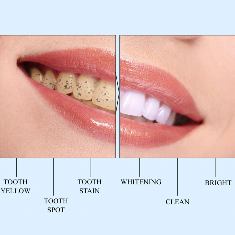 

1pcs Teeth Whitening Pen Tooth Brush Essence Oral Hygiene Cleaning Serum Remove Plaque Stains Dental Tools Toothpaste ToothBrush
