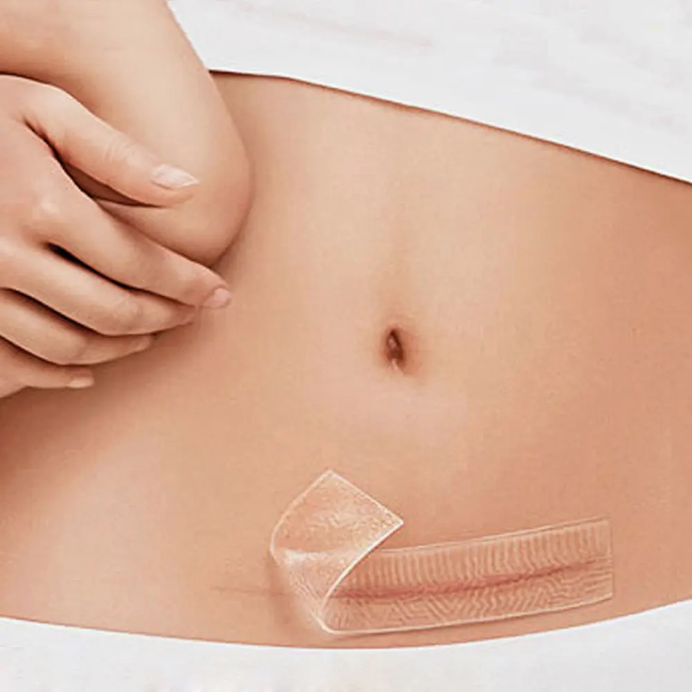 2017 Silicone Gel Scar Therapy Patch 7.5CM*4.5CM be Washed and Reused