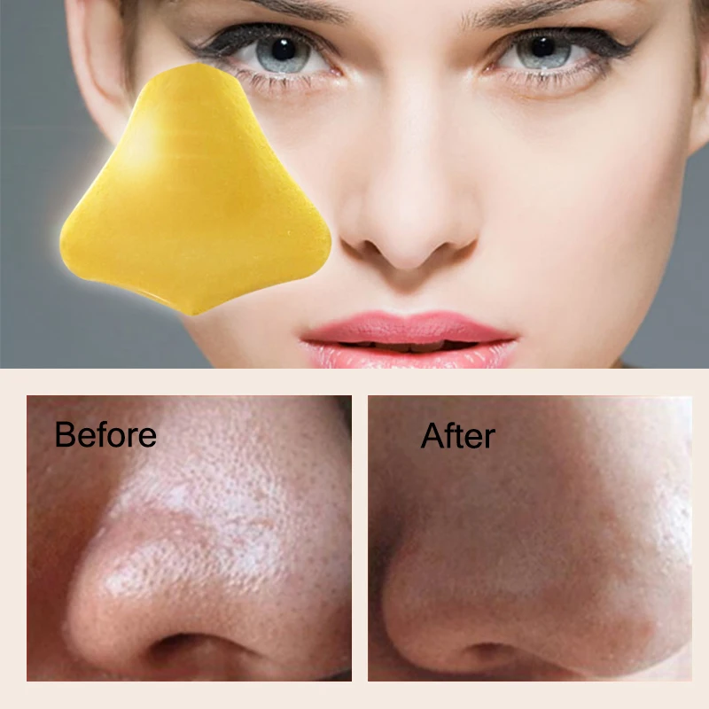 

50pcs Nose Mask Use After Blackhead Remover Gold Collagen Patch to Minimize Pores Oil Control Hydration