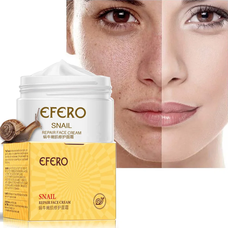 

EFERO Acne Scar Removal Snail Repair Cream Moisturizing Anti Aging Snail Essence Whitening Face Cream Wrinkle Remover Lifting