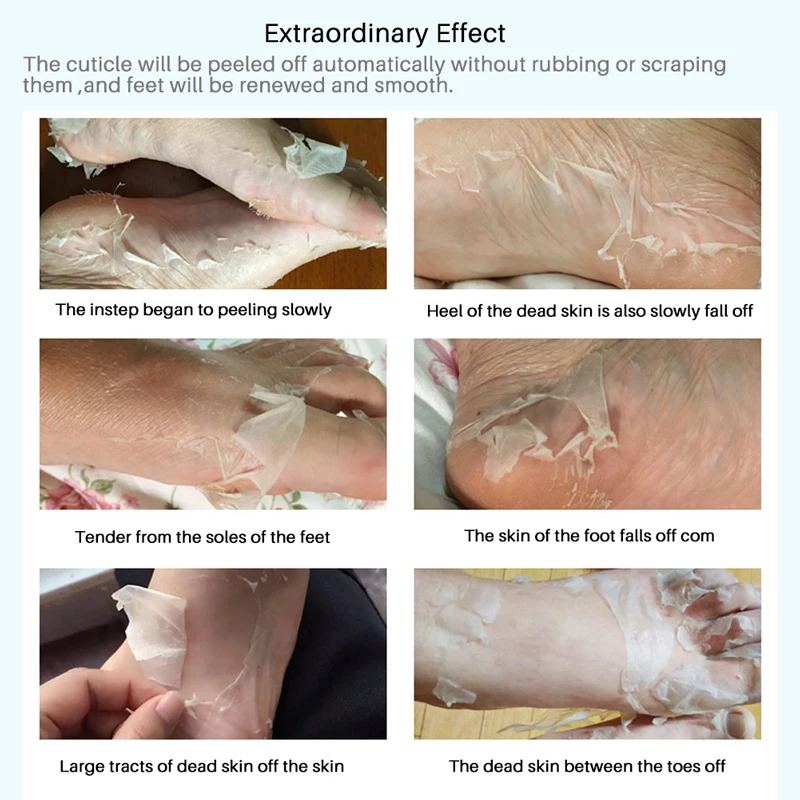 6 piezas = 3 pares de máscara de pie exfoliante calcetines de pedicura exfoliación para máscara de pies quitar tacones de piel muerta pelar pies máscara para piernas efero 6 piezas = 3 pares de máscara de pie exfoliante calcetines de pedicura exfoliación para máscara de pies quitar tacones de piel muerta pelar pies máscara para piernas efero
