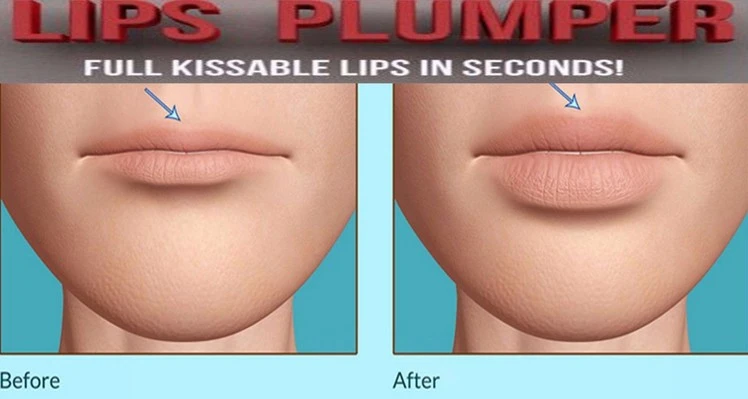 Lip Booster Extreme Lipgloss Enhancer Voller Volume Lippen Grote Verkoop + Snelle big|volume lipsbig lips - AliExpress