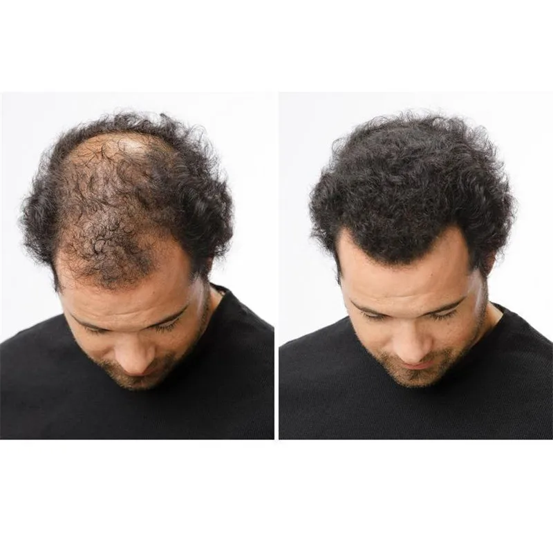 inspire-uplift-anti-hair-loss-fibers-anti-hair-loss-fibers-3529564651636_1000x