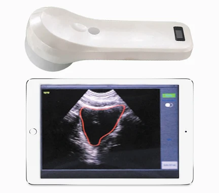 

2019 BProbe-2 4D Wireless Bladder Scanner