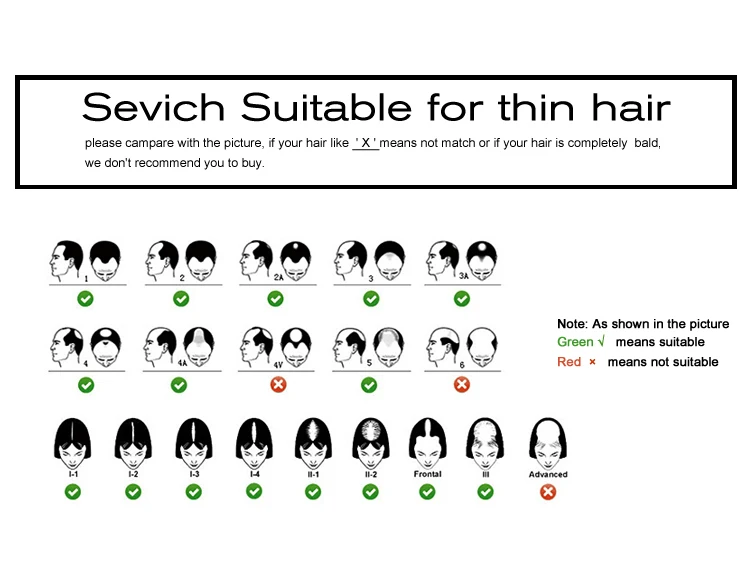 sevich--_10