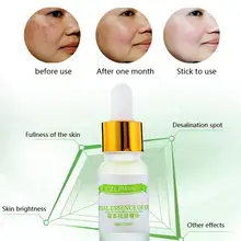 1 шт. MEssence глубокий увлажняющий Восстанавливающий отбеливатель веснушки Speckles beauty против морщин Mar12