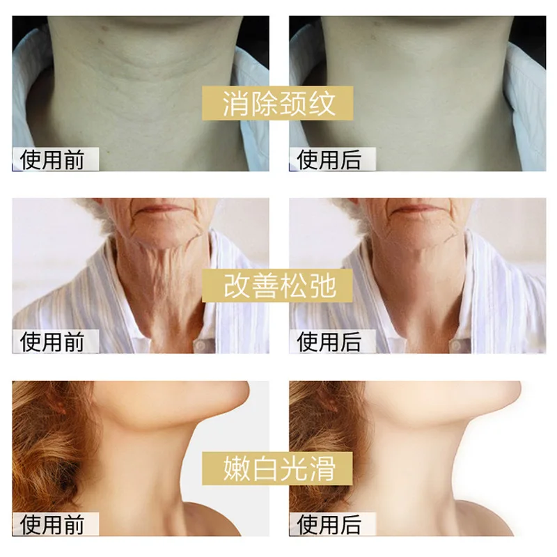 Крем для шеи женский с козьим молоком 100 г|neck cream|cream neckskin care |