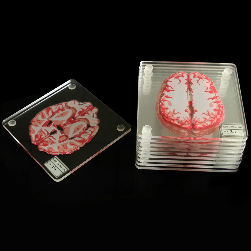  Brain Specimen Coasters Set 3D Organ Brain Artwork Brain Slices Square Acrylic Glass Drinks Table C
