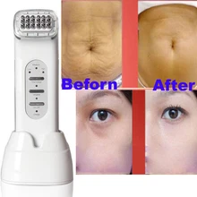 US $38.66 49% OFF|RF Wrinkle Removal Beauty Machine Dot Matrix Facial Thermage Radio Frequency Face Lifting Skin Tightening RF Thermage Skin Sare-in Face Skin Care Tools from Beauty &amp; Health on Aliexpress.com | Alibaba Group