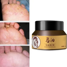 Конское масло крем для ног Уход за ногами для спортсмена ноги зуд мозоли анти-обветривание пилинг Антибактериальный шрам плохой ноги мазь