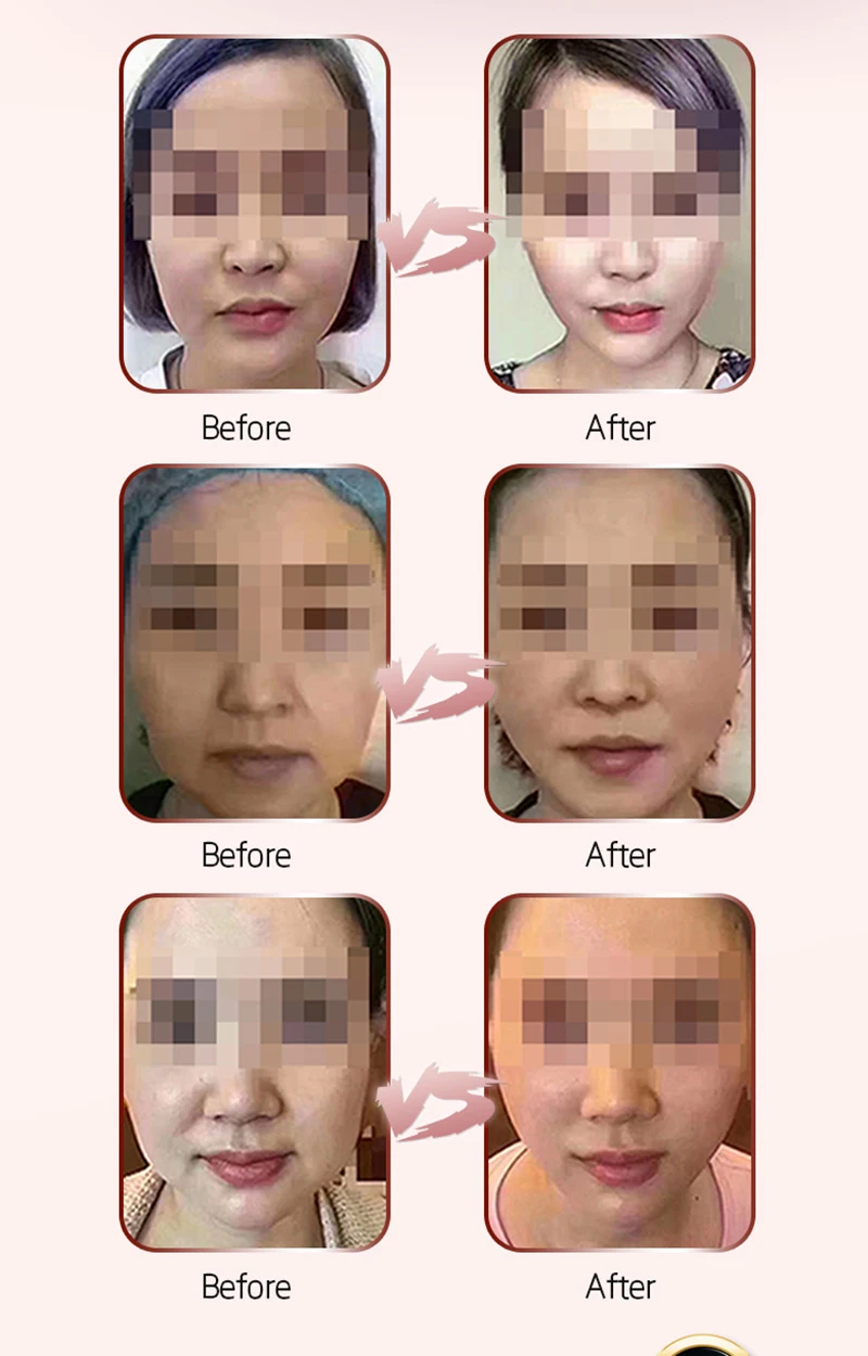 Cuidados com a Pele Instrumento de Beleza Máquina da Beleza do Enrugamento Mini Hifu Multifuncional Ultra-sônico Facial Rejuvenescimento Anti Envelhecimento 18 Utensílios de cuidado facial