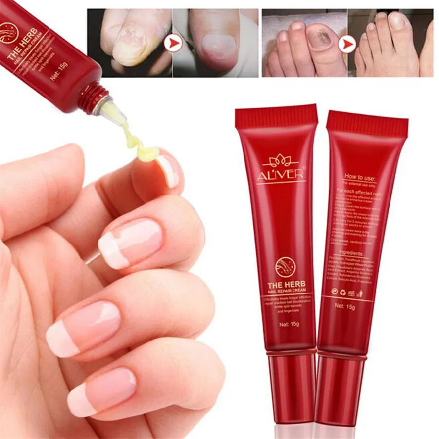 Nail Treatment 1pc 15g Fungal Nail Treatment Essence Nail And Foot