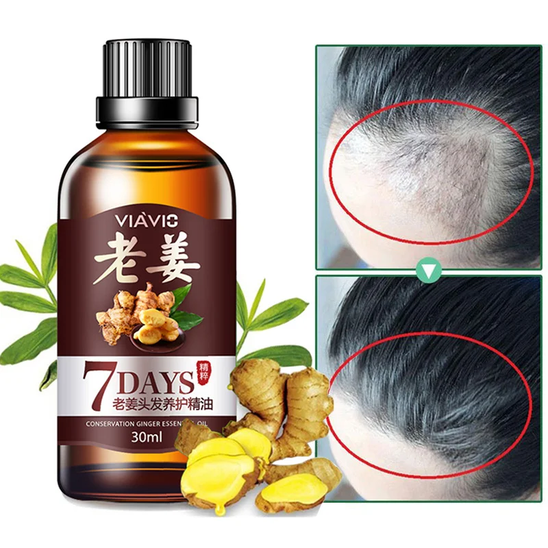 

Effective Hair Growth Ointment Hair Care Healthy Essence Oil Hair Loss Treatment Ginger Anti Loss Treatment Essence Bin TSLM1