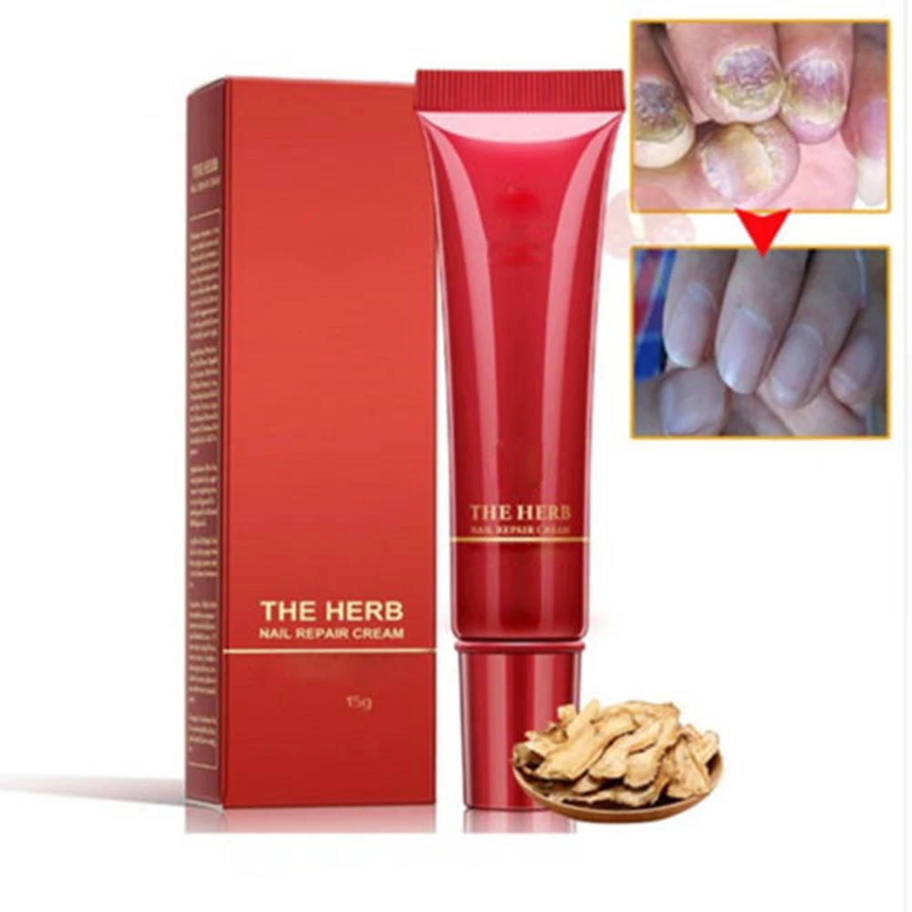 Nail Foot Protector Skin Care Cream 15g Nail Fungus Treatment the Herb Nail Repair Cream 2018 New Nail Foot Protector Skin Care Cream 15g Nail Fungus Treatment the Herb Nail Repair Cream 2018 New
