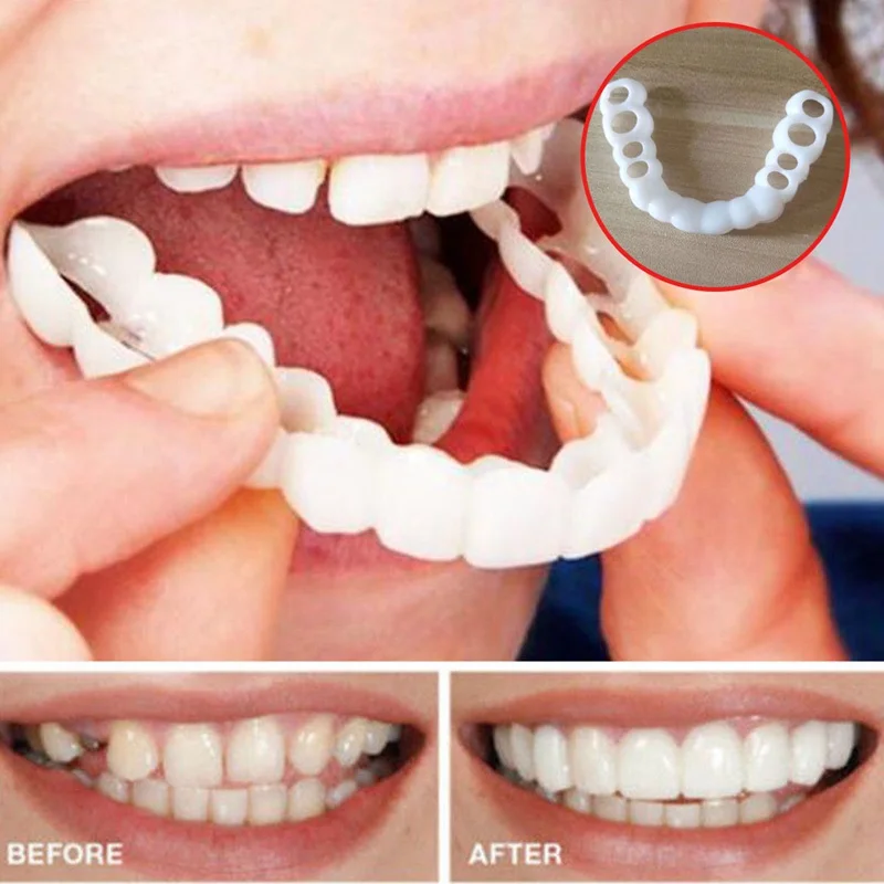 Красивый комфорт Fit Flex косметические зубы протез Зубы Топ косметические виниры - Цвет: White