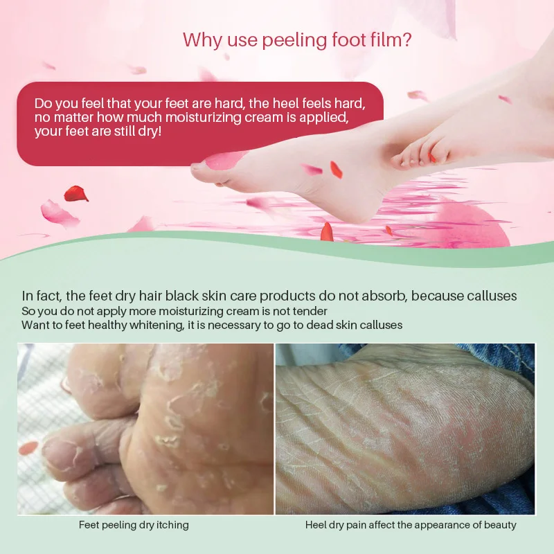 Online 2 Pasang = 4 PC Bayi Kaki Mengupas Masker Kulit Mati Kutikula Tumit Exfoliating Pedikur Kaus Kaki Kaki Perawatan Kaki masker untuk Kaki Mengelupas Masker