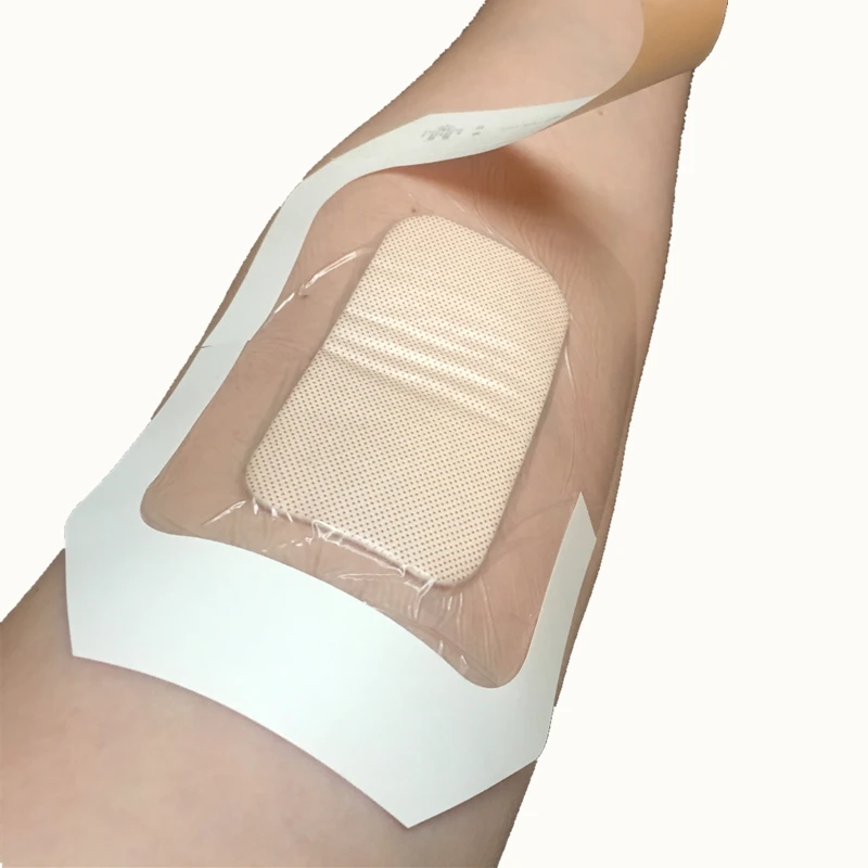

10cmx12cm Picture frame sterile transparent PU film IV Dressings for fixing I.V catheters Window Dressings With Pad