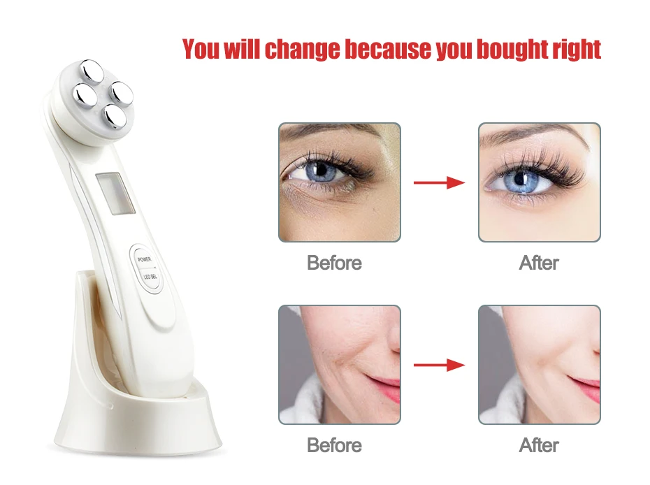 5in1 LED Photon Face Skin Rejuvenation Electroporation Mesotherapy with RF,EMS,Multi-function Radio Frequency Skin Care machine(14)