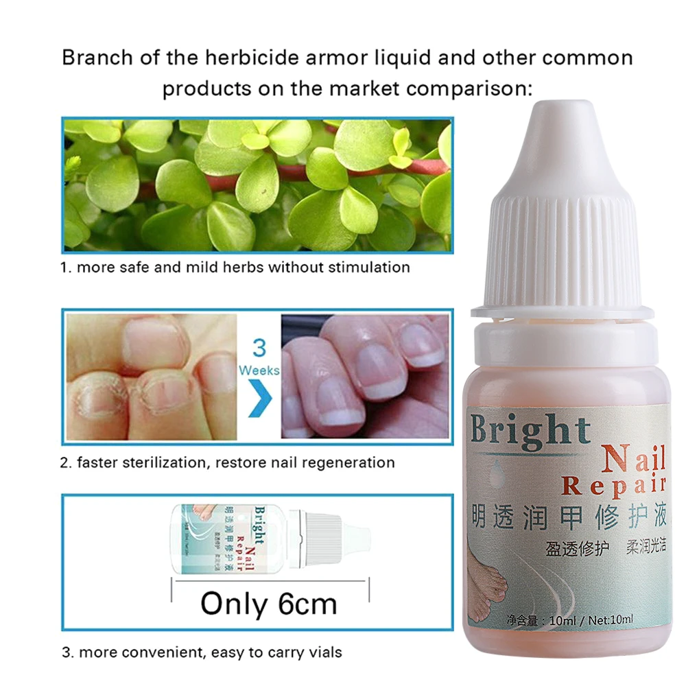 15g Nail Treatment Cream Bright Repair Nail Fungal Onychomycosis Removal Essence Foot Care Anti Infection Foot Nail Health Care 15g Nail Treatment Cream Bright Repair Nail Fungal Onychomycosis Removal Essence Foot Care Anti Infection Foot Nail Health Care