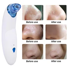 Электронное средство для удаления прыщей и угрей вакуумный дермабразии лицо поры Очиститель Машина QS888