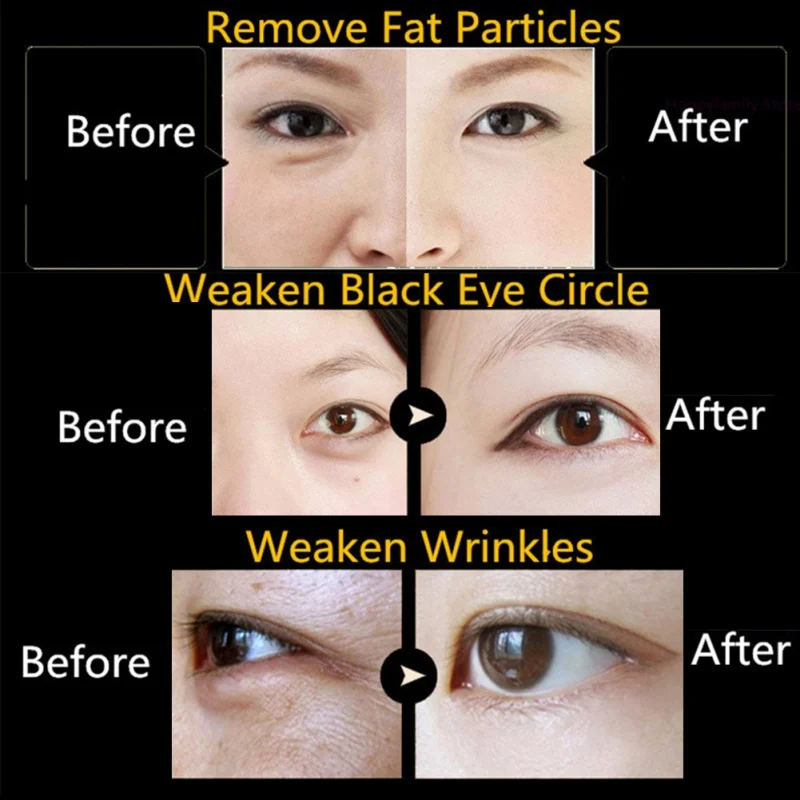 5 пар патчей для глаз против морщин удалить черный глаз уход за лицом новая золотая с кристаллами коллагена маска для глаз