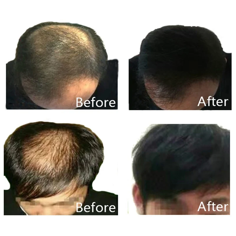 DR0158 (4)