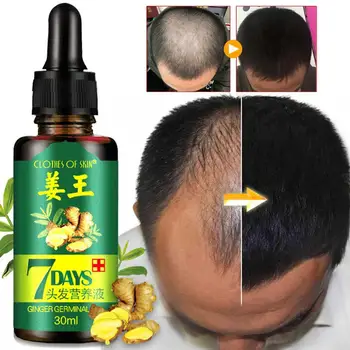 

30ml Unisex Fast Growth Hair Essence Liquid Anti-Hair Loss Oil Nutrition and Restore The Vitality of Hair Root