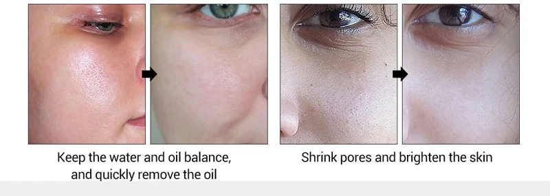 Hyaluronic-acid-snail-secretion-3_01