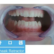 Стоматологический Ретрактор C-type устройство для открытия синего отбеливания зубов ортодонтический пластиковый рот для губ может быть высокотемпературный