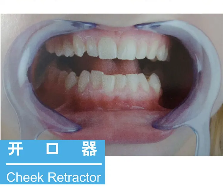 

Dental Check Retractor C-type Opening Device Blue Teeth Whitening Orthodontic Plastic Mouth Lip Opener Can be high-temperature