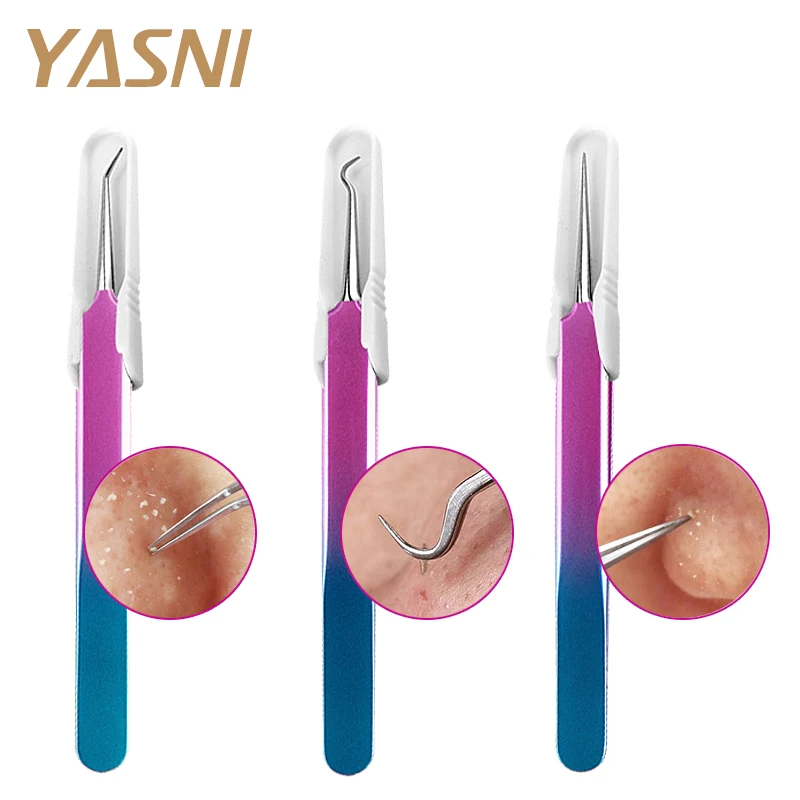 

Stainless Steel Blackhead Remover Acne Extractor Remover Needle Kit Bend Curved Pimple Blemish Tweezer Face Care Tool FS93