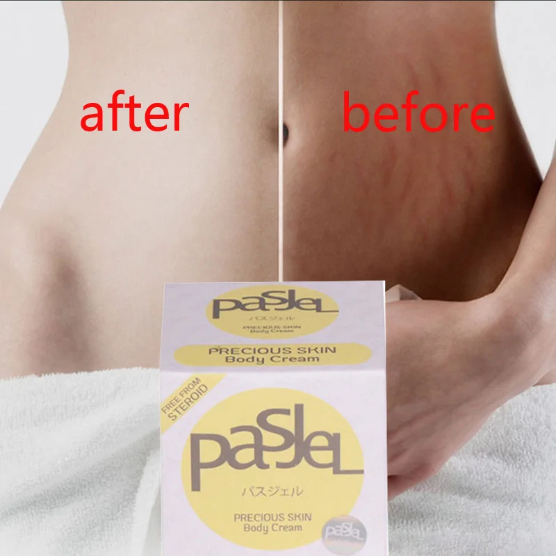 

Thailand Precious Pregnancy Cream Stetch Maks Remover Sar Removal Powerful Postpartm Obesity Skin Body Cream