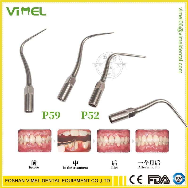 

FSVIMEL 1 PCS Dental Scaler Tips For P52/P59